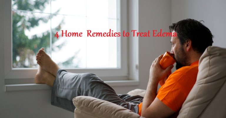 4 Home Remedies to Treat Edema - LearningJoan