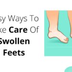 Easy Ways to Take Care of Swollen Feet - LearningJoan
