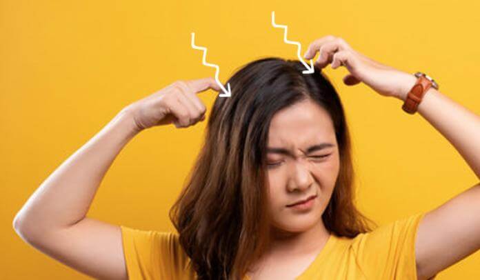 7 Home Remedies to Remove 'Itching Of the Head' In Summer - LearningJoan