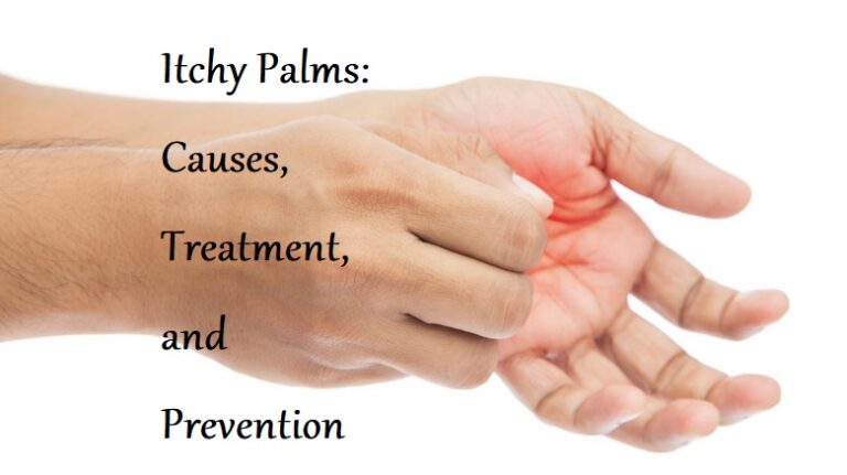 Itchy Palms