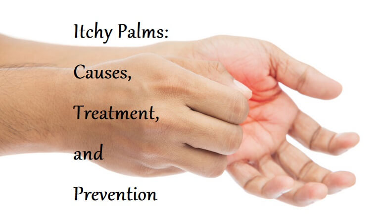 itchy-palms-causes-treatment-and-prevention-learningjoan