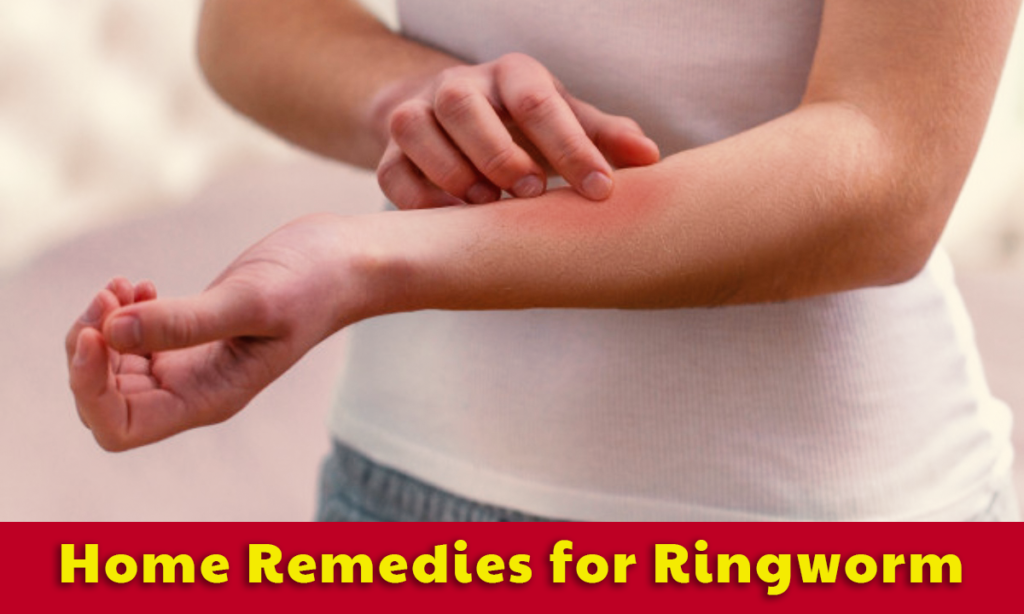 Home Remedies for Ringworm - LearningJoan