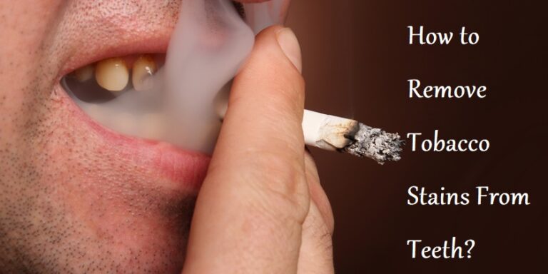 remove tobacco stains from teeth