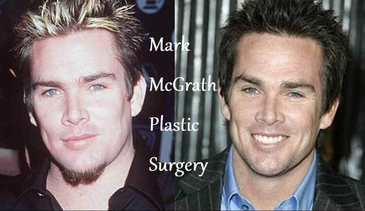 Mark McGrath Plastic Surgery
