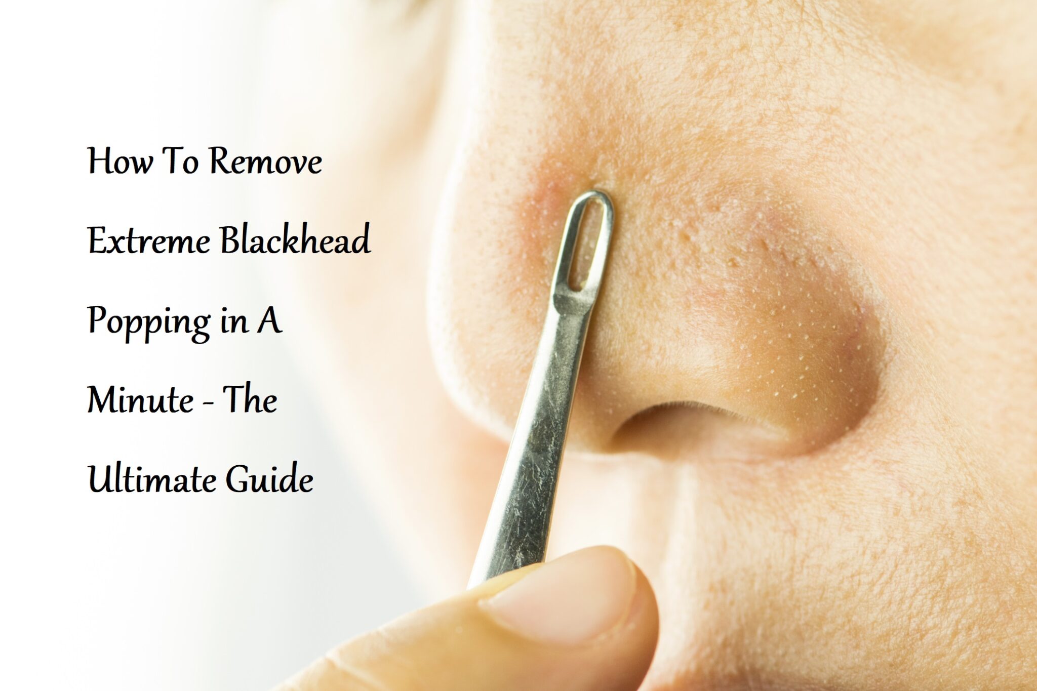 How To Remove Extreme Blackhead Popping in A Minute