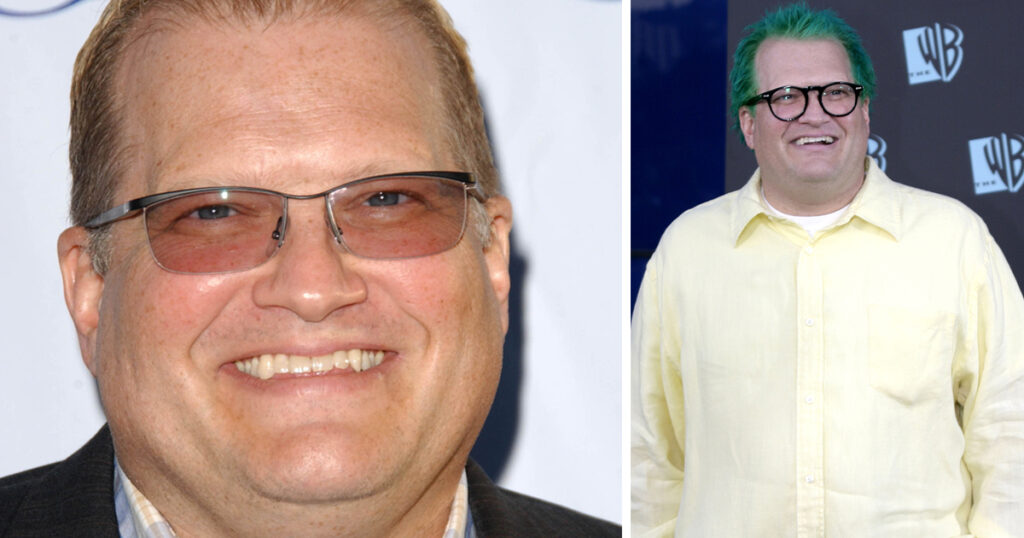Did Drew Carey Have Weight Loss Surgery?