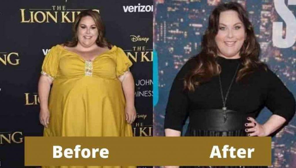 Before And After Pictures of Her Weight Loss