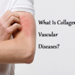 Collagen Vascular Diseases