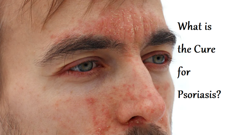 Cure for Psoriasis