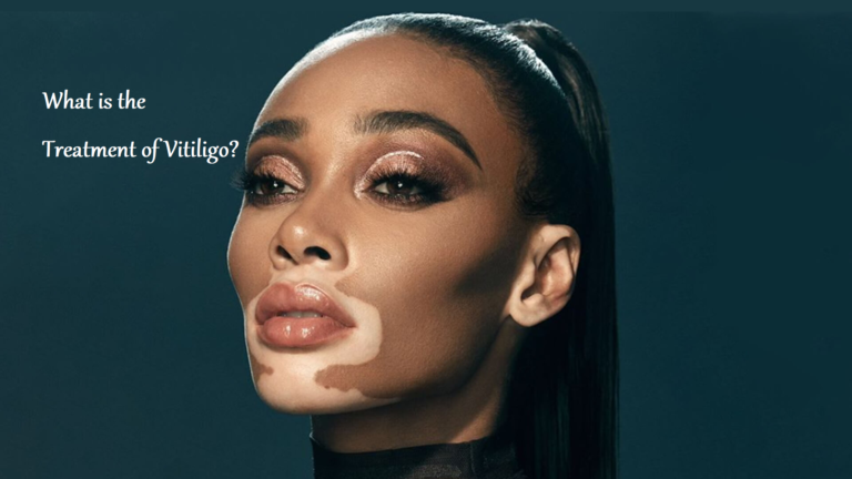 Treatment of Vitiligo