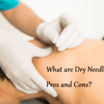 Dry Needling Pros and Cons