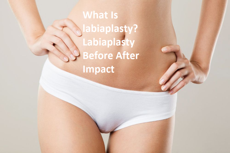 Labiaplasty Before After