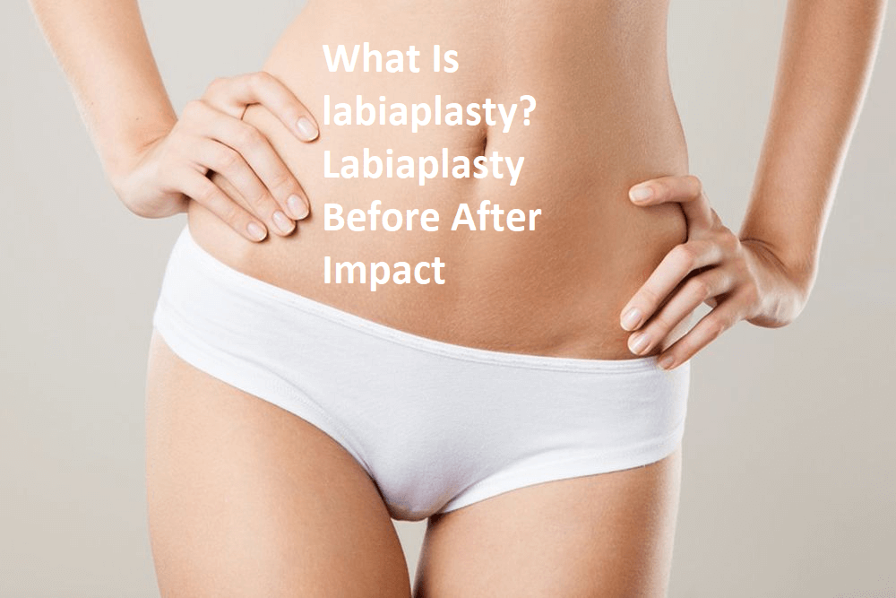 O que é labioplastia Labioplastia Antes Depois Impacto
