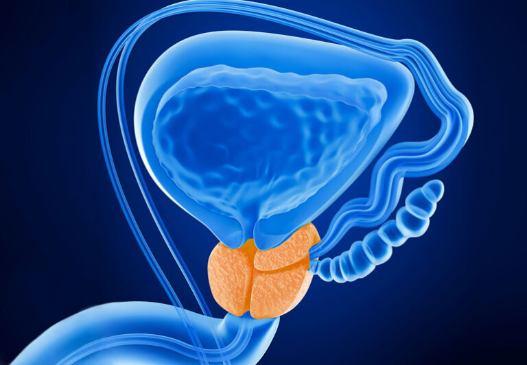 The Importance of Early Detection and Prostate Cancer Screening