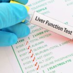 Why Are Liver Function Tests Done?