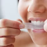 Why Teeth Whitening Strips Will Always Be a Favorite