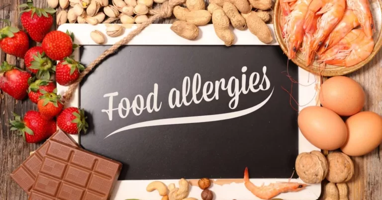 Food Allergies Unpacked: From Triggers to Management