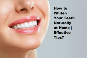 How to Whiten Your Teeth Naturally at Home | Effective Tips?
