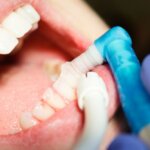 Dental Care in Longview, Texas: Your Comprehensive Guide