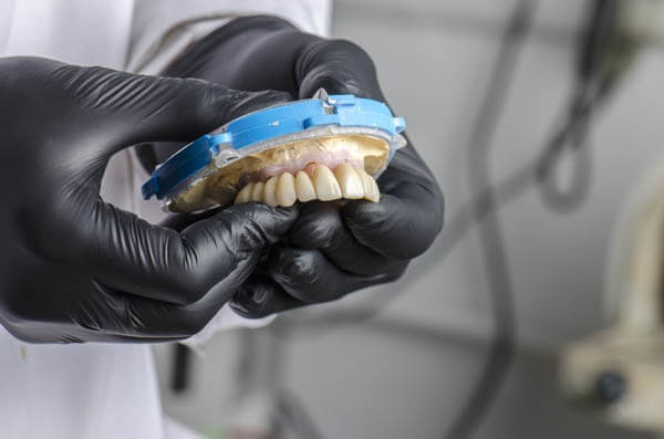 Implant Supported Dentures: Benefits and Why They Are a Game Changer for Dental Health