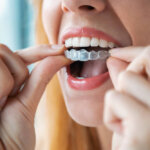 invisalign cost tallahassee fl