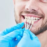 Bad Veneers Before and After: A Comprehensive Guide to Understanding Potential Risks and Outcomes