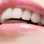 Cosmetic Dentistry in Pascagoula, MS: Enhancing Your Smile