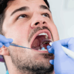 extractions baldwin me