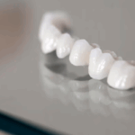 porcelain crowns Laguna Hills CA