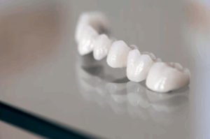 porcelain crowns Laguna Hills CA