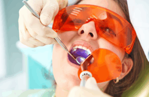 tooth colored fillings bowling green ky