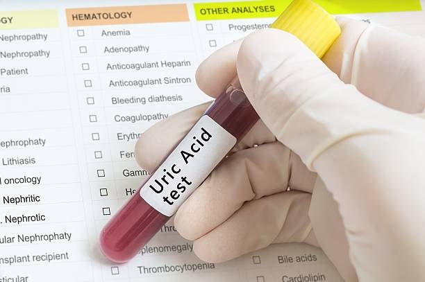 Uric Acid Normal Range: Everything You Need to Know