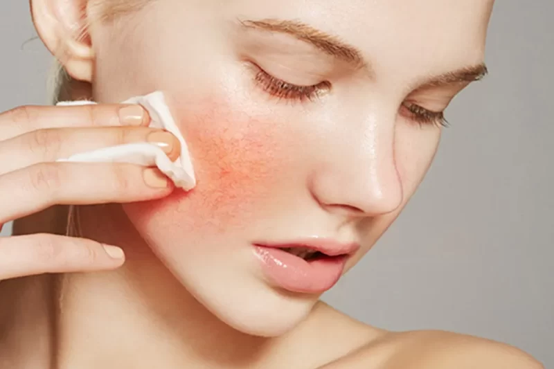 Signs Your Skin Barrier Is Damaged — And How to Repair It Fast