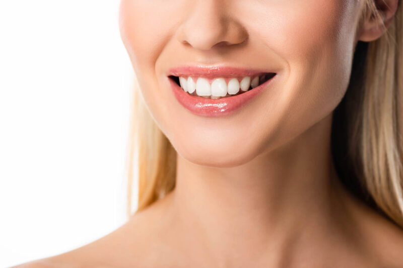 Veneers in Pearl, MS: Your Complete Guide to a Flawless, Natural-Looking Smile