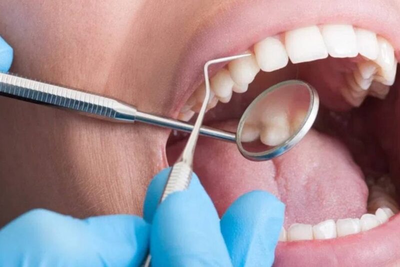 What Locals Need to Know About Gum Disease Treatment in Louisville, KY