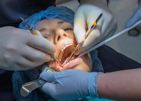 Tooth Extraction: What to Expect Before, During and After Your Procedure