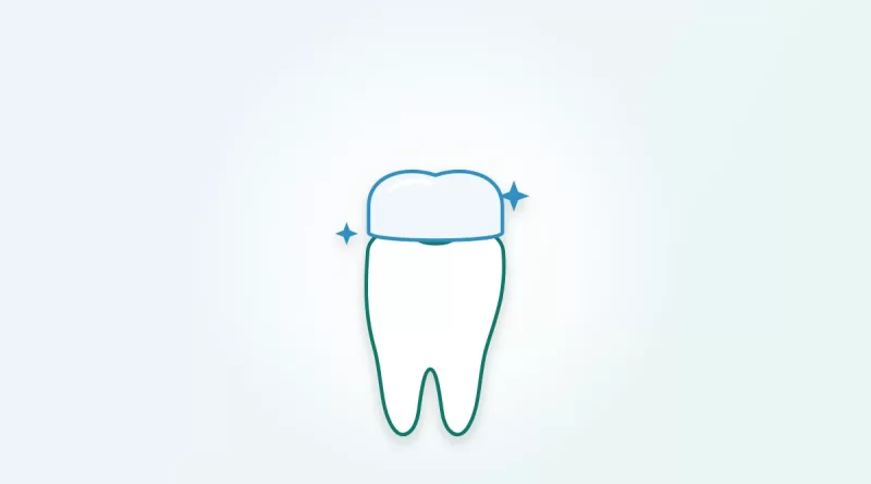 Illustration of a tooth with a white ceramic crown