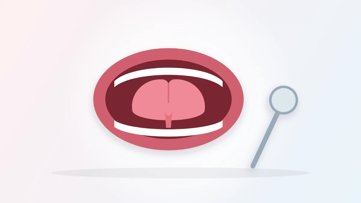 Tongue Tie in Adults: 7 Signs, Treatment and Recovery