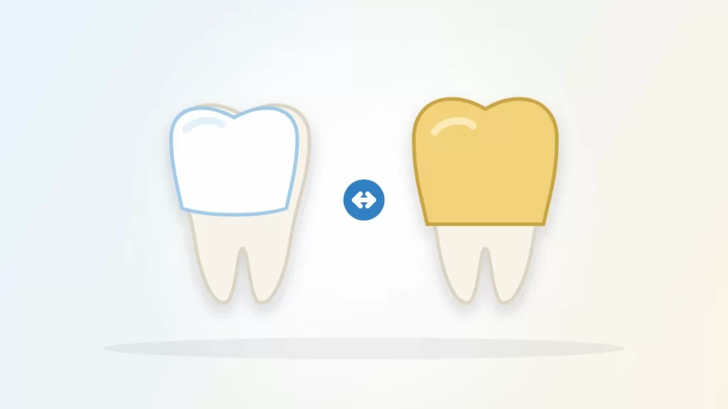 Veneers vs crowns illustration: a tooth with a thin front shell beside a tooth with a full cap