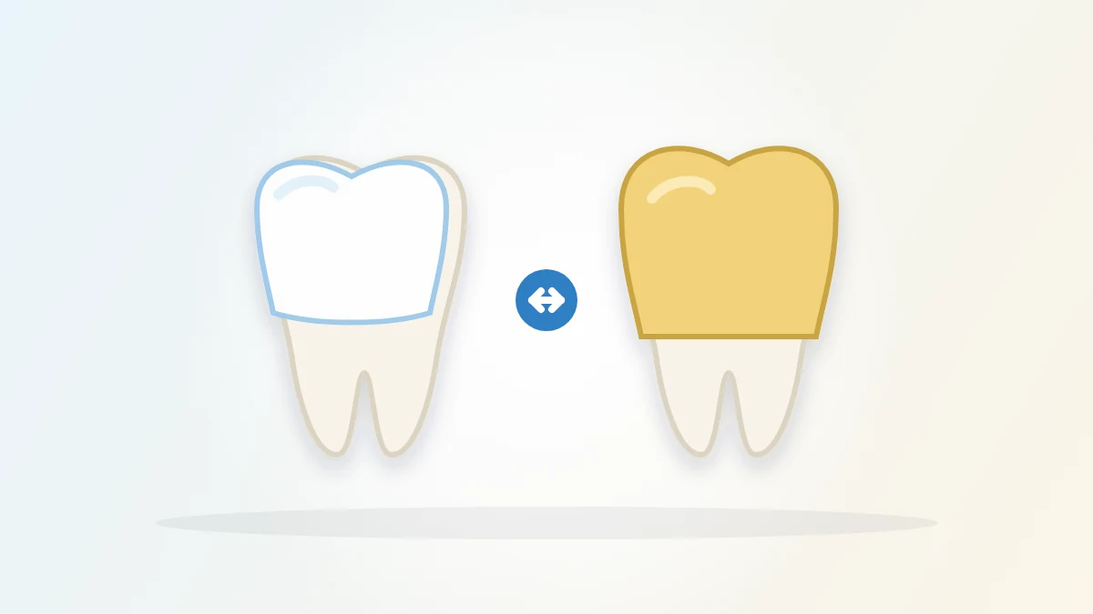 Veneers vs Crowns: 7 Key Differences and How to Choose