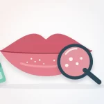 White spots on lips illustration: a magnifying glass over lips with tiny pale spots, next to a lip balm