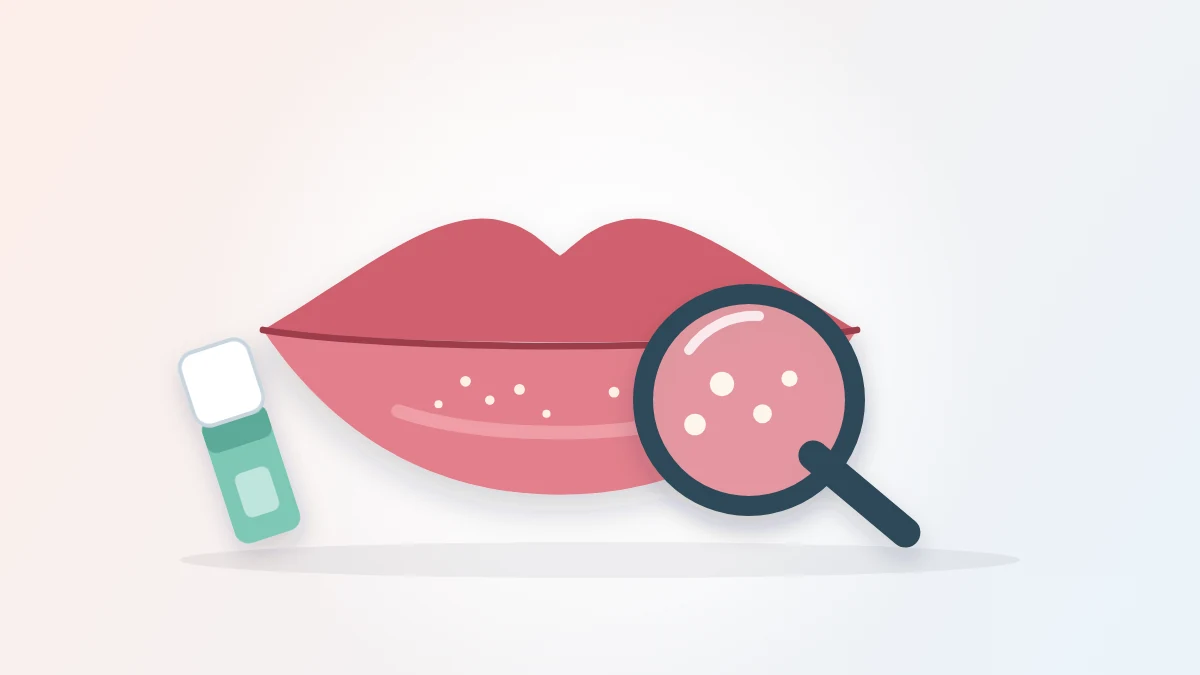 White Spots on Lips: 7 Common Causes and When to Worry